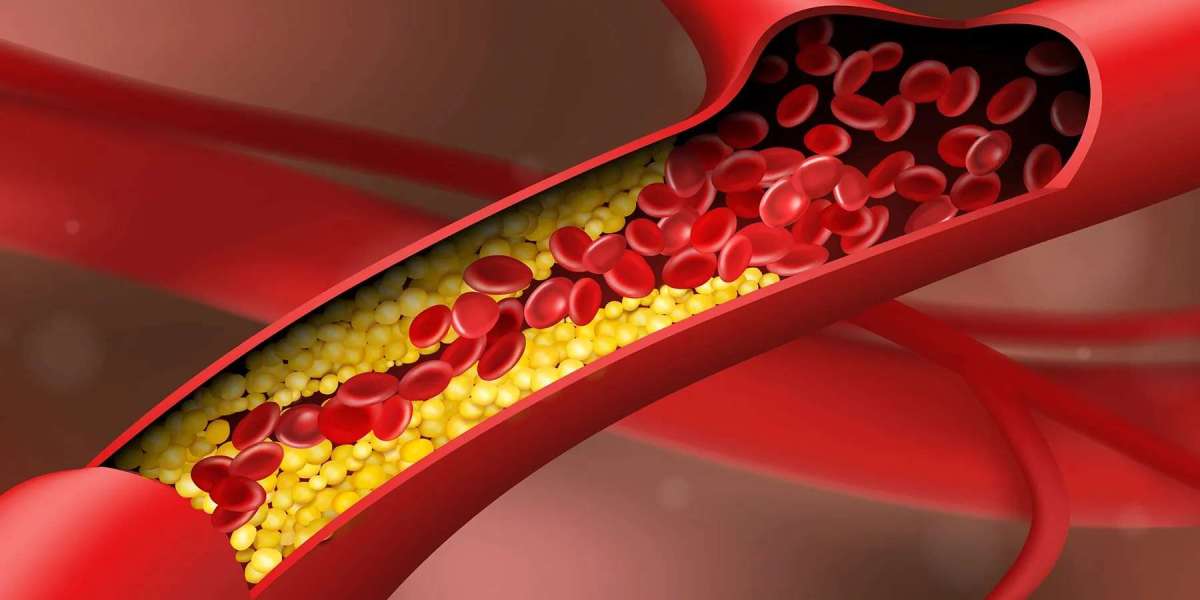 Foods that Cleanse Arteries and Improve Blood Circulation