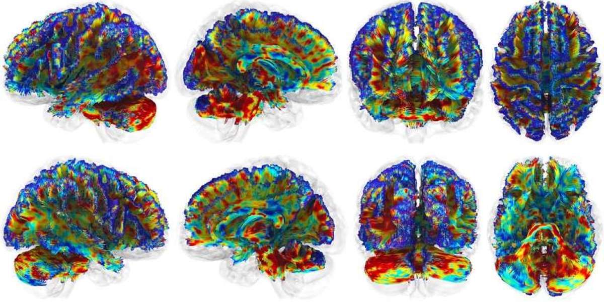 How Red Light Therapy Could Revolutionize Brain Protection Against CTE in Athletes