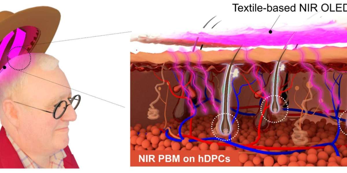 Cap-Like OLED Wearable Could Revolutionize Hair Loss Treatment by Replacing Bulky Helmets