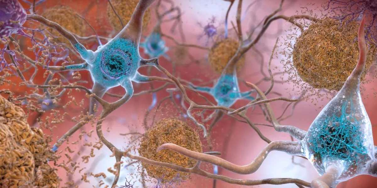 Alzheimer’s Breakthrough: New Treatment Restores Memory in Mice Through Epigenetic Reprogramming