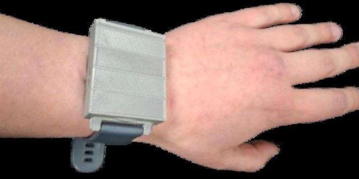 Smartwatch Device to Detect Microplastics in the Human Body: A Breakthrough in Non-Invasive Health Monitoring