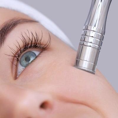 Microdermabrasion in Islamabad - F7